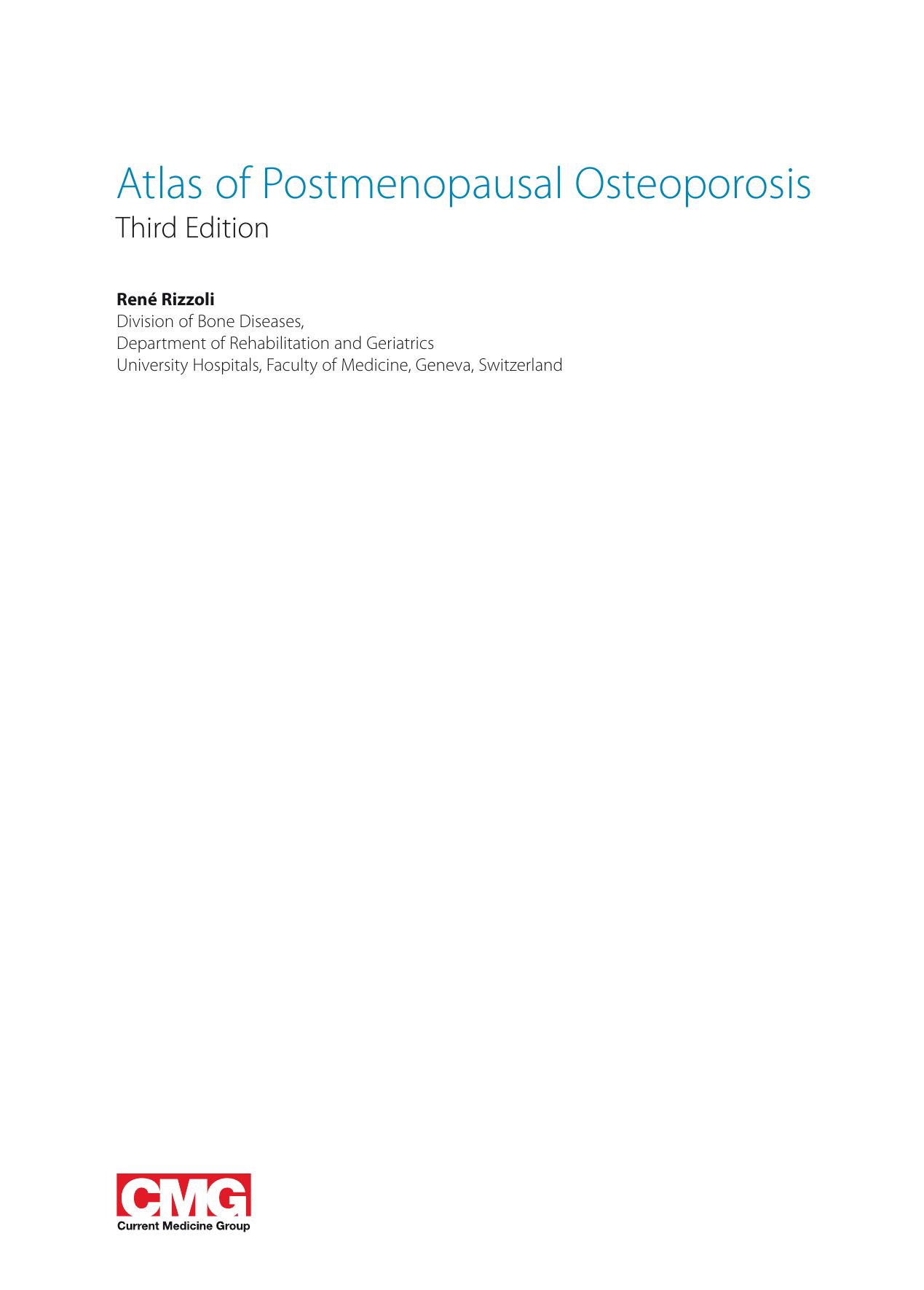 Atlas of Postmenopausal Osteoporosis by Serge Ferrari Johann D Ringe (auth.) René Rizzoli (eds.)