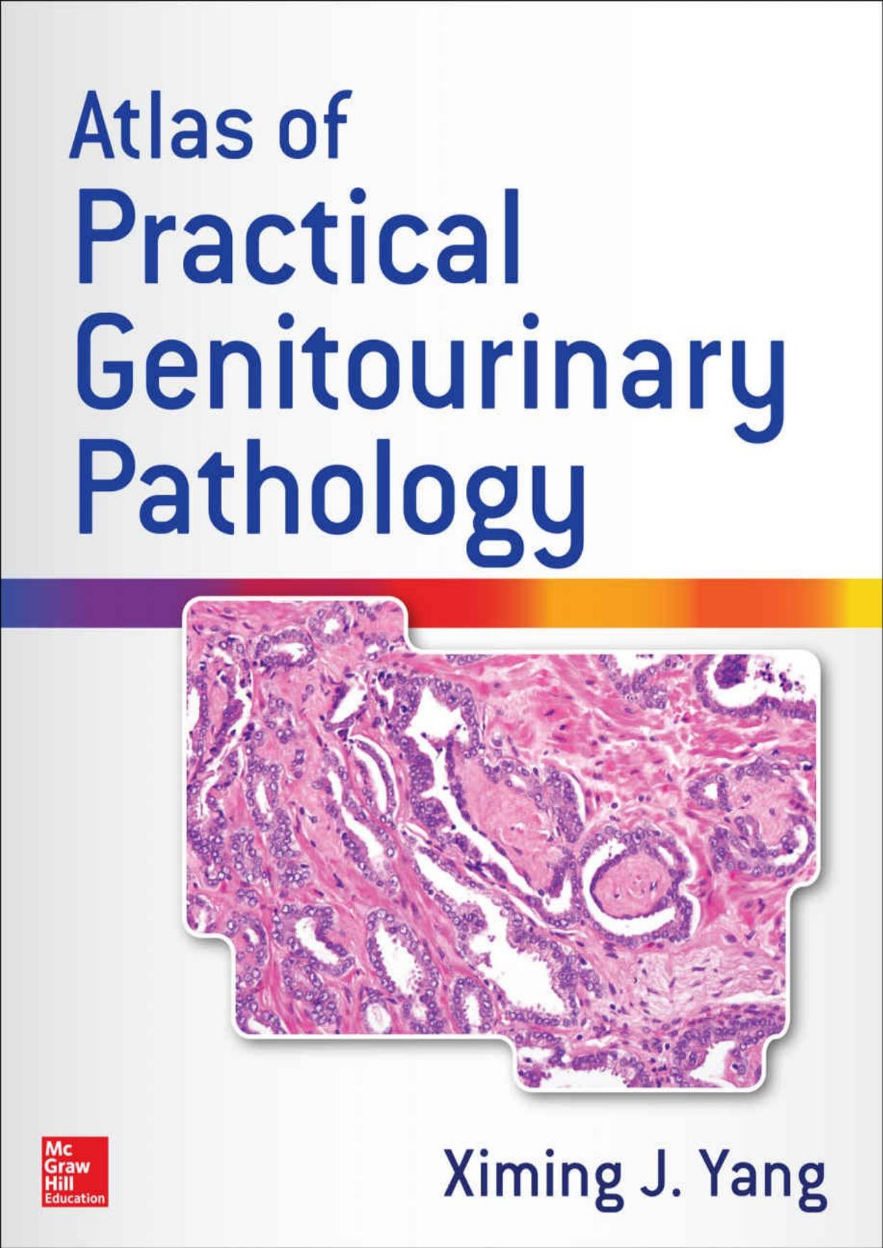 Atlas of Practical Genitourinary Pathology by Ximing James Yang