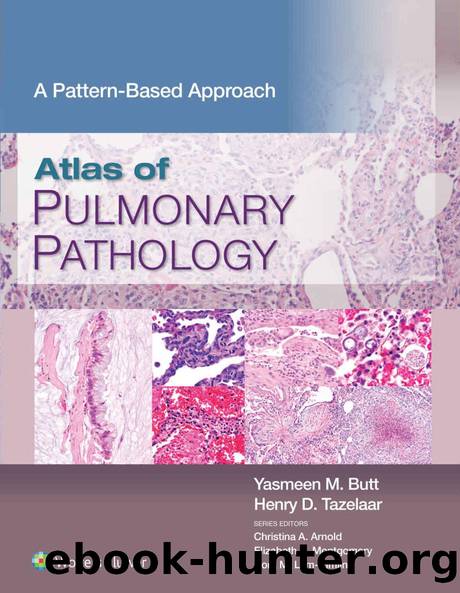 Atlas of Pulmonary Pathology by Yasmeen Mahmood Butt & Henry D. Tazelaar