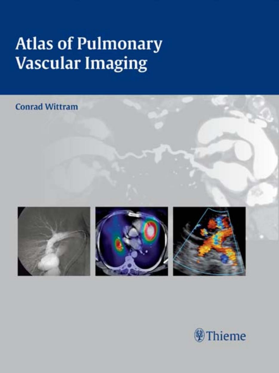 Atlas of Pulmonary Vascular Imaging by Unknow