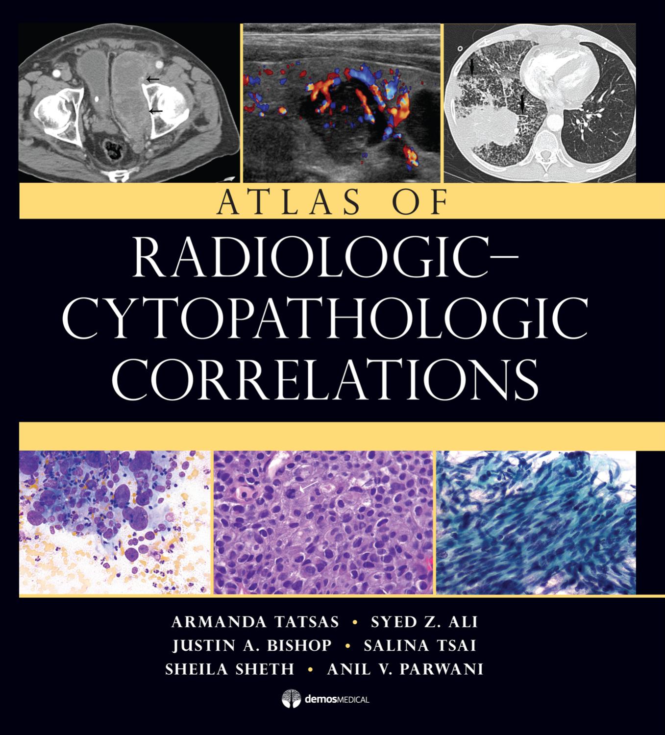 Atlas of Radiologic-Cytopathologic Correlations by Armanda Tatsas Syed Z. Ali Justin A. Bishop Salina Tsai Sheila Sheth Anil V. Parwani