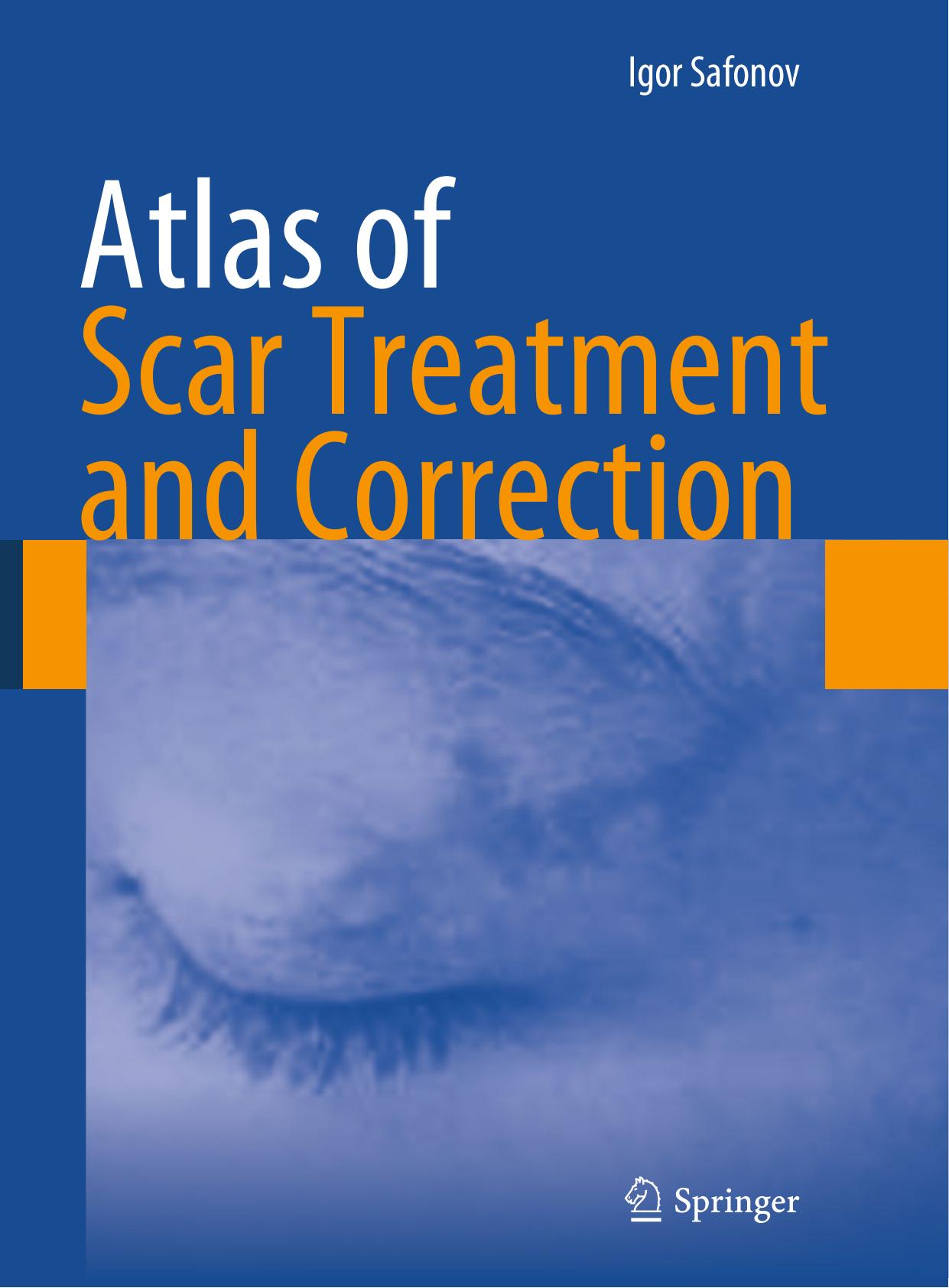 Atlas of Scar Treatment and Correction by Igor Safonov (auth.)