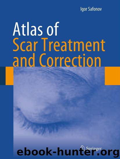 Atlas of Scar Treatment and Correction by Igor Safonov
