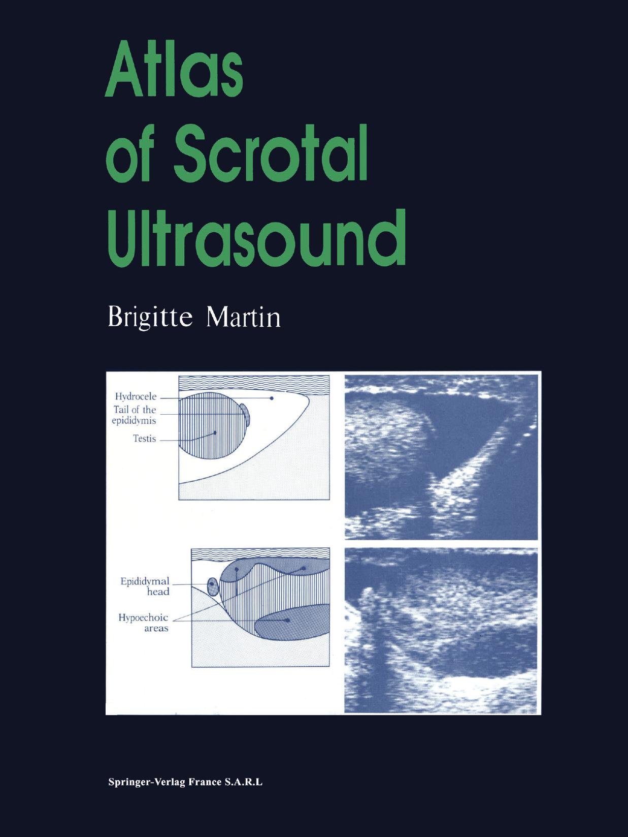 Atlas of Scrotal Ultrasound by Brigitte Martin M.D. (auth.)