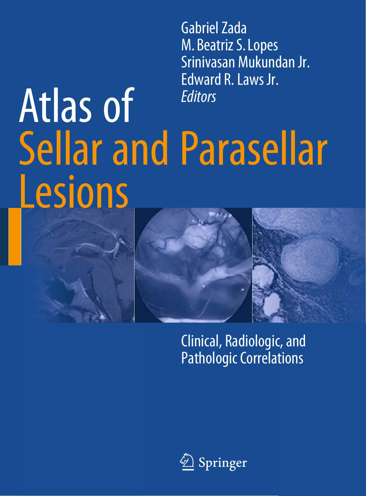 Atlas of Sellar and Parasellar Lesions: Clinical, Radiologic, and Pathologic Correlations by Unknow