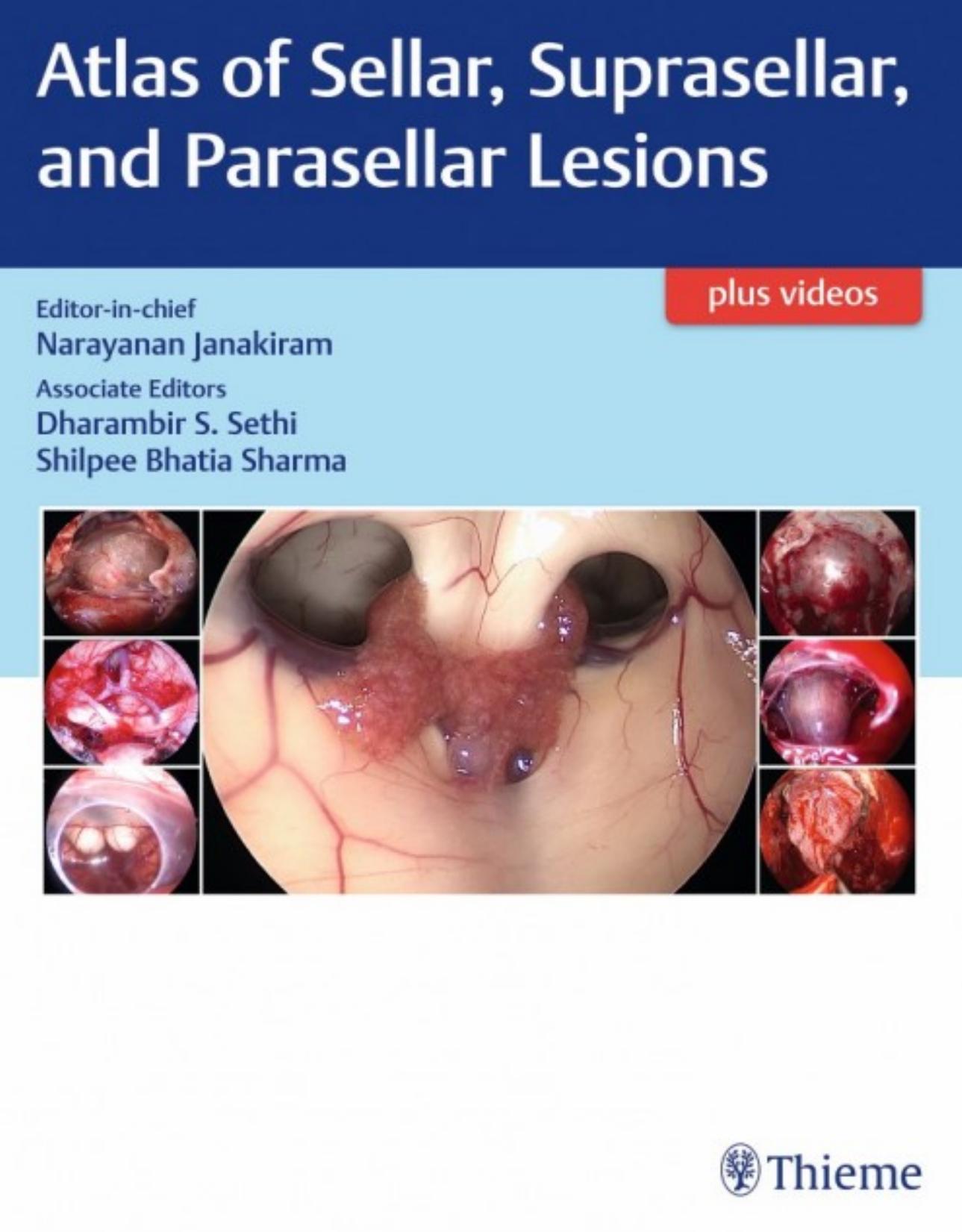 Atlas of Sellar, Suprasellar and Parasellar Lesions by Unknow