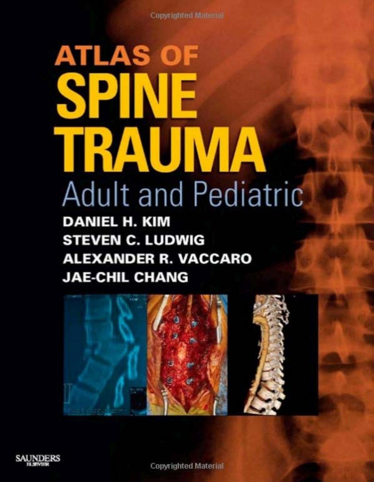 Atlas of Spine Trauma: Adult and Pediatric by Daniel H. kim
