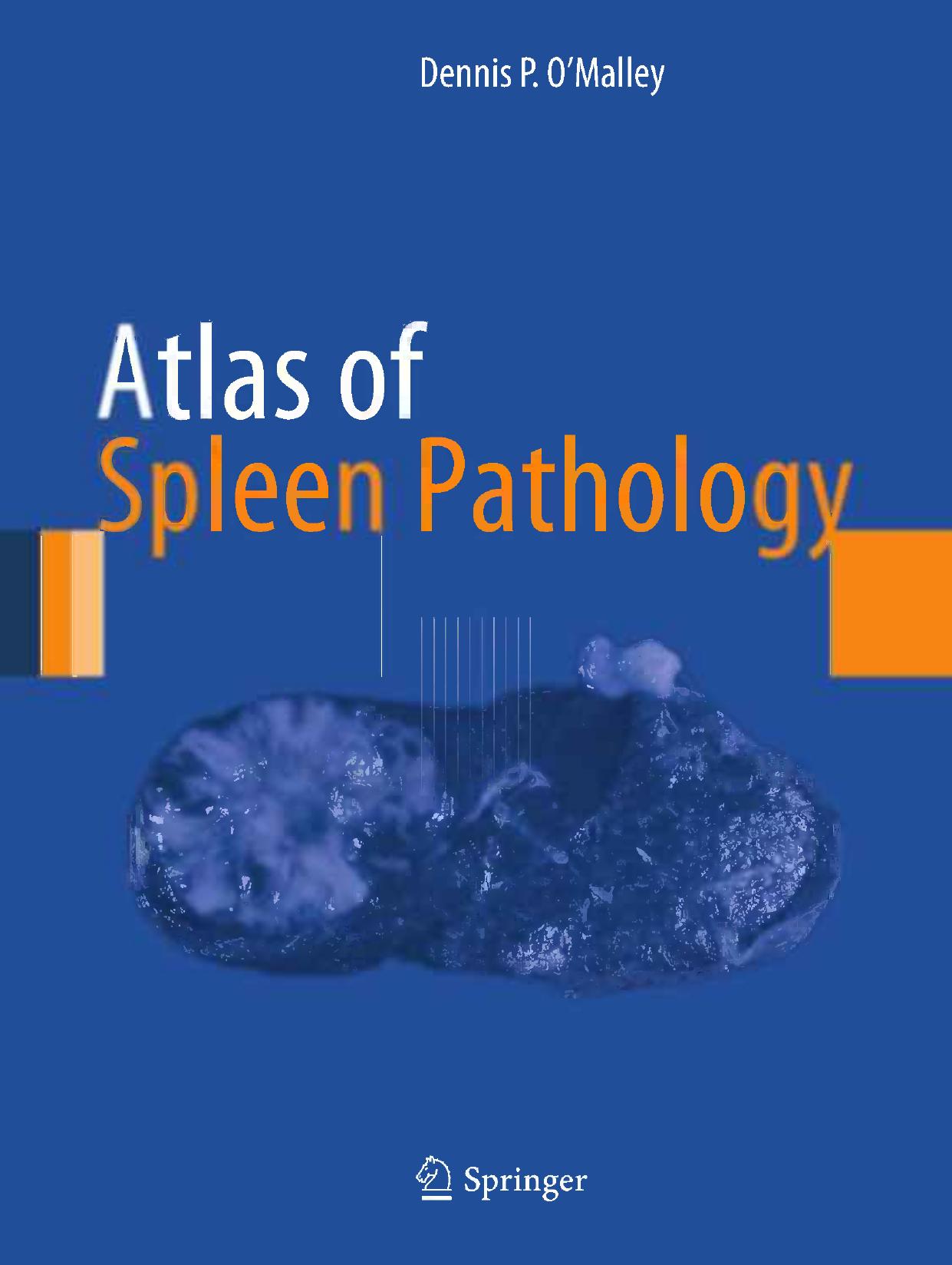 Atlas of Spleen Pathology by Dennis P. O'Malley (auth.)