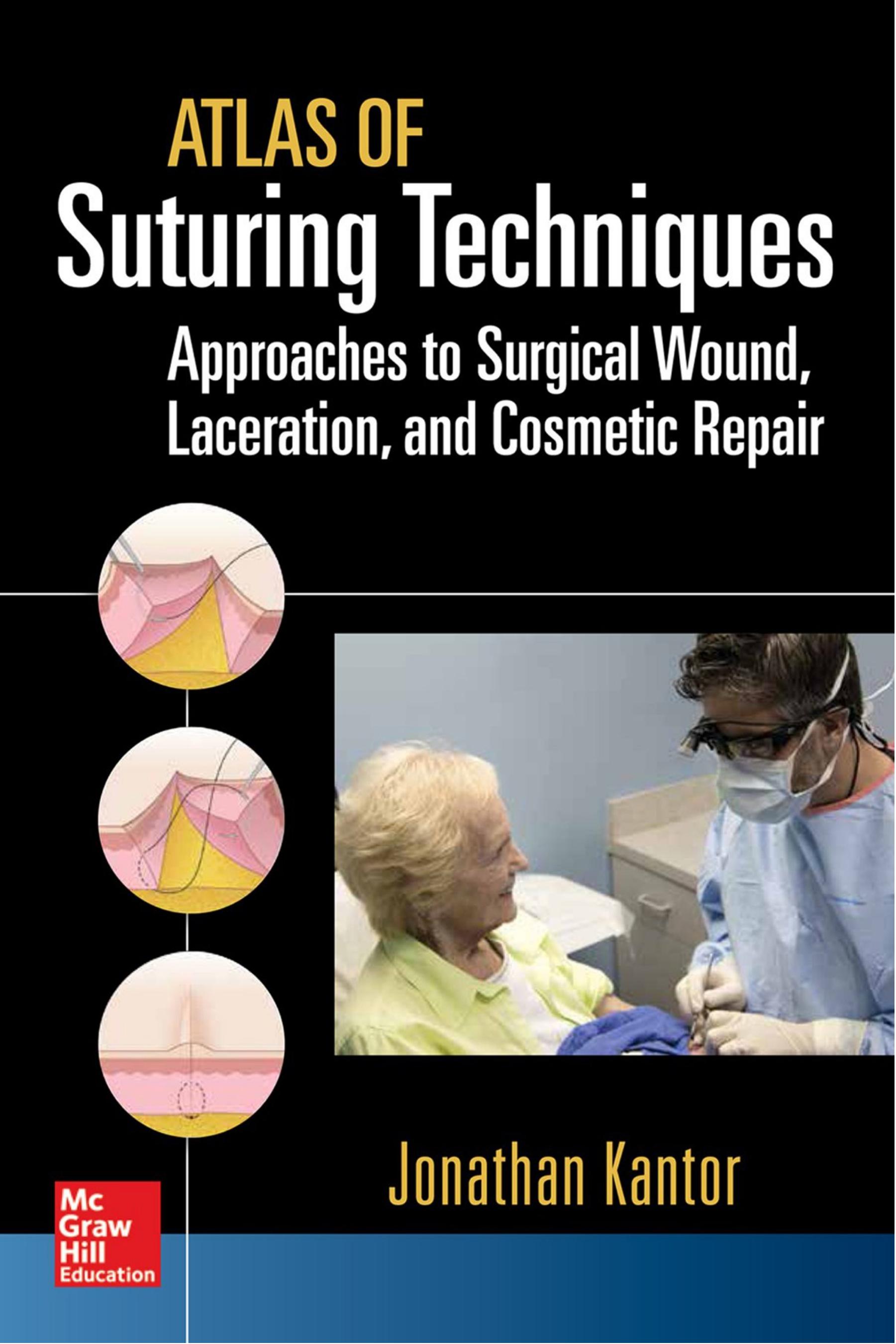 Atlas of Suturing Techniques: Approaches to Surgical Wound, Laceration, and Cosmetic Repair by Jonathan Kantor