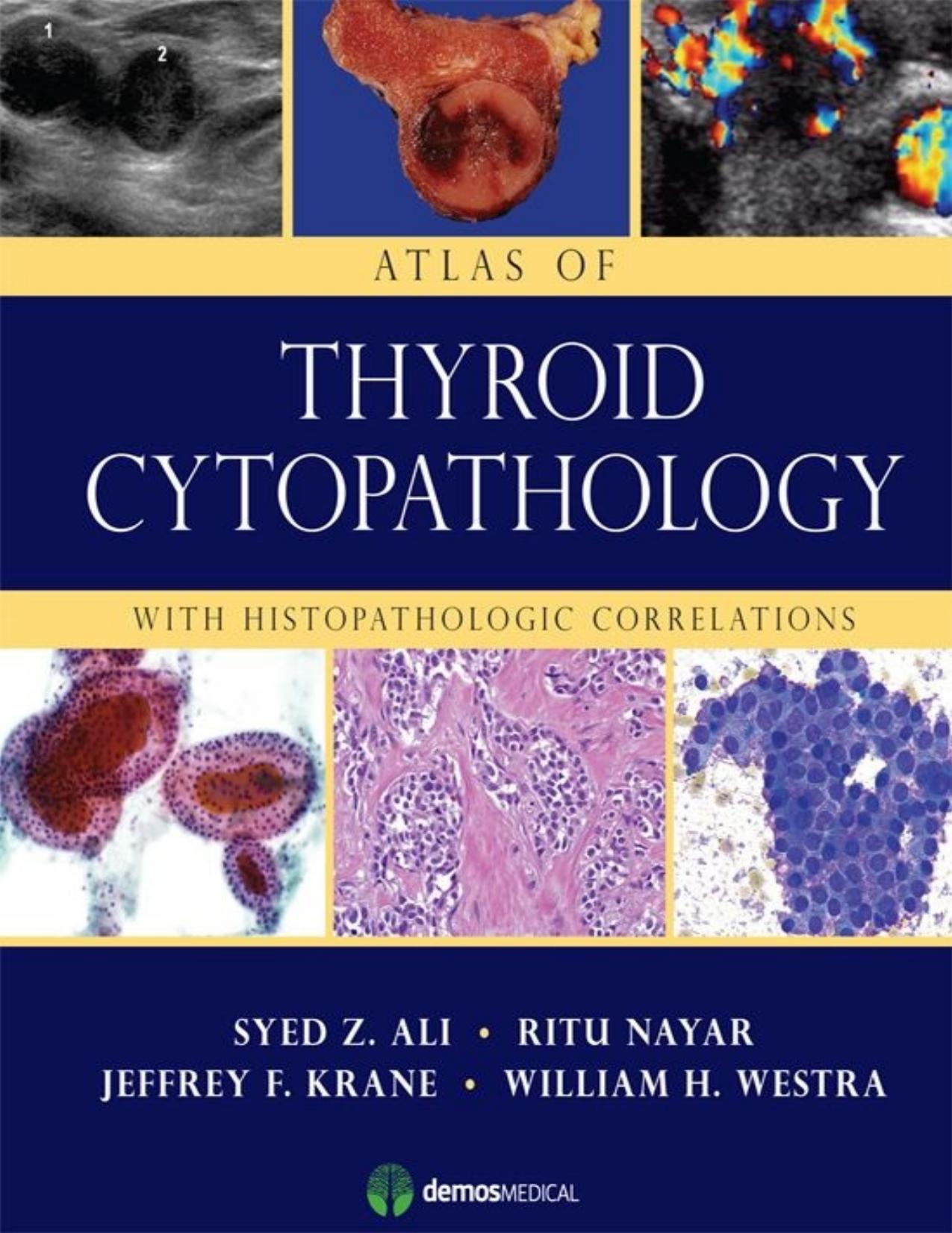 Atlas of Thyroid Cytopathology: With Histopathologic Correlations by Syed Z. Ali MD Ritu Nayar MD Jeffrey F. Krane MD PhD William H. Westra MD