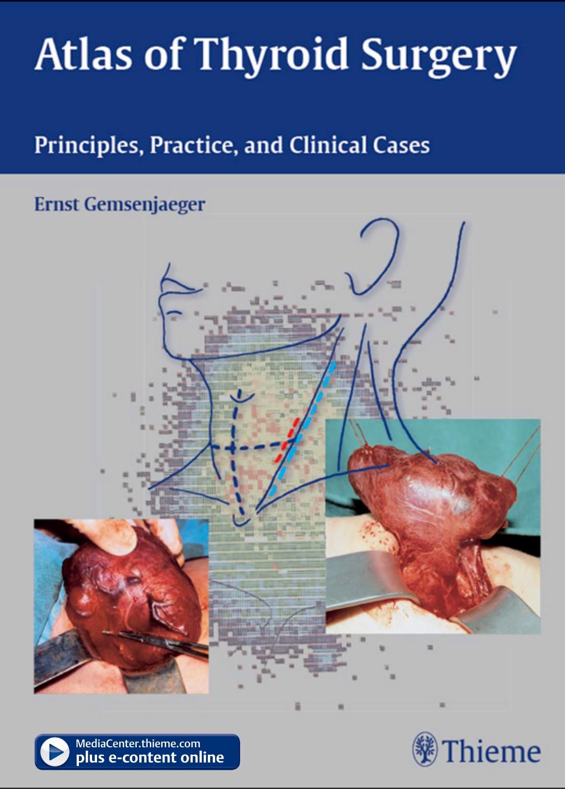 Atlas of Thyroid Surgery: Principles, Practice and Clinical Cases by Ernst Gemsenjaeger and Ernst Gemsenjäger