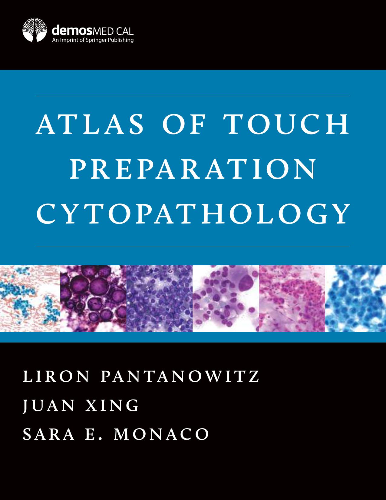 Atlas of Touch Preparation Cytopathology by springer ,Liron Pantanowitz, MD / Juan Xing, MD / Sara E. Monaco, MD by Atlas of Touch Preparation Cytopathology Liron Pantanowitz MD / Juan Xing MD / Sara E. Monaco MD