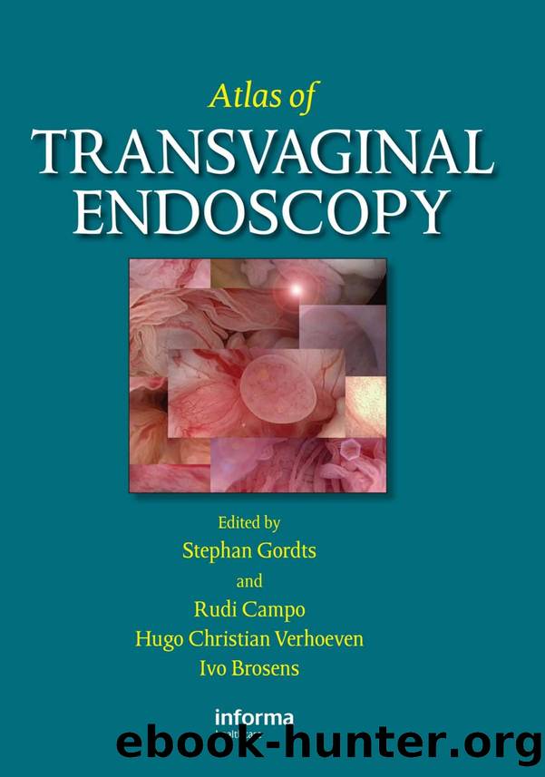 Atlas of Transvaginal Endoscopy by Unknown