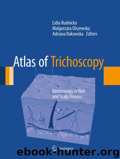 Atlas of Trichoscopy by Lidia Rudnicka Malgorzata Olszewska & Adriana Rakowska