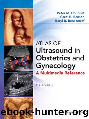 Atlas of Ultrasound in Obstetrics and Gynecology by unknow