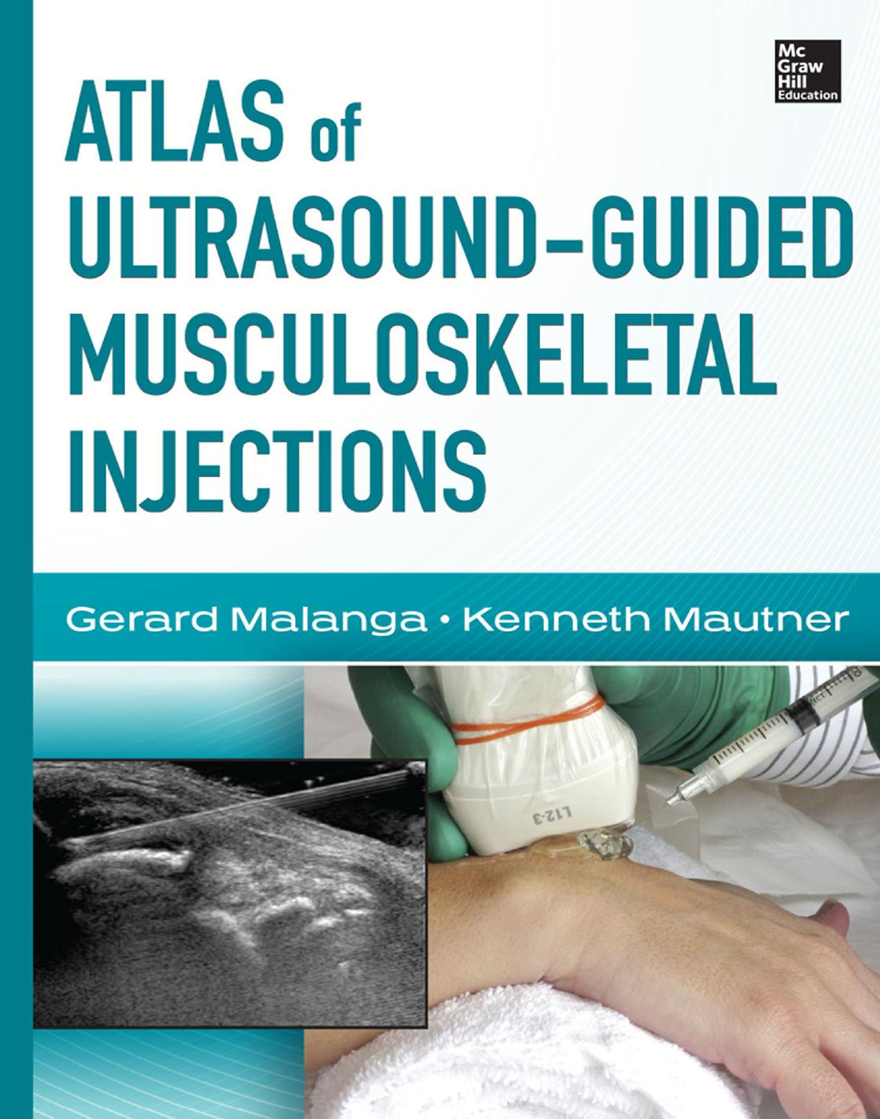Atlas of Ultrasound-Guided Musculoskeletal Injections by Gerard Malanga Kenneth Mautner