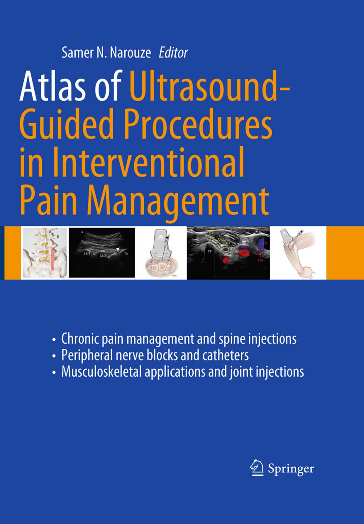 Atlas of Ultrasound-Guided Procedures in Interventional Pain Management by Marc A. Huntoon (auth.) Samer N. Narouze (eds.)