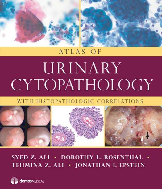 Atlas of Urinary Cytopathology With Histopathologic Correlations by Dr. Syed Z. Ali MD Dorothy L. Rosenthal MD Tehmina Z. Ali MD Jonathan I. Epstein MD