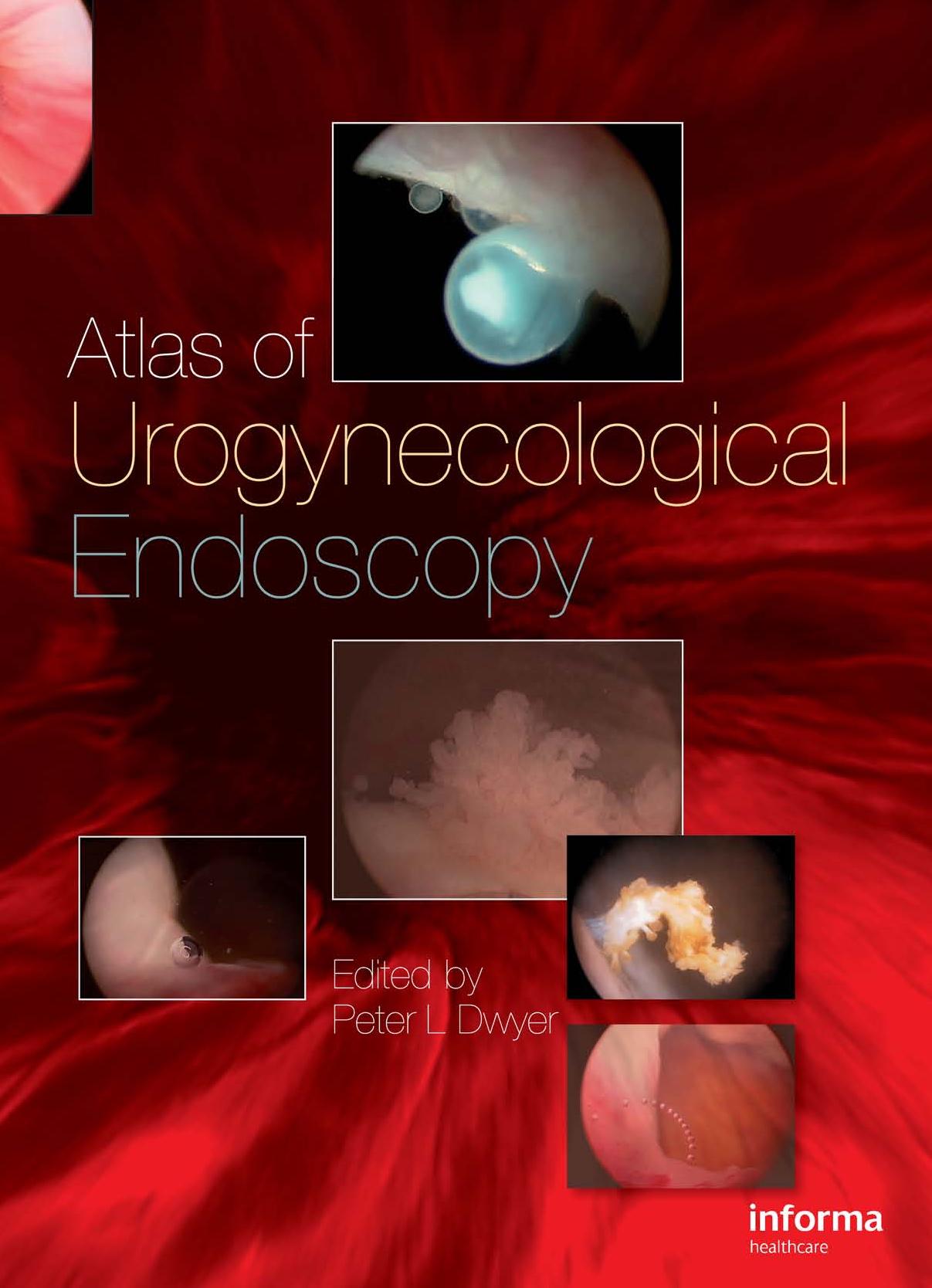 Atlas of Urogynecological Endoscopy by Peter L. Dwyer