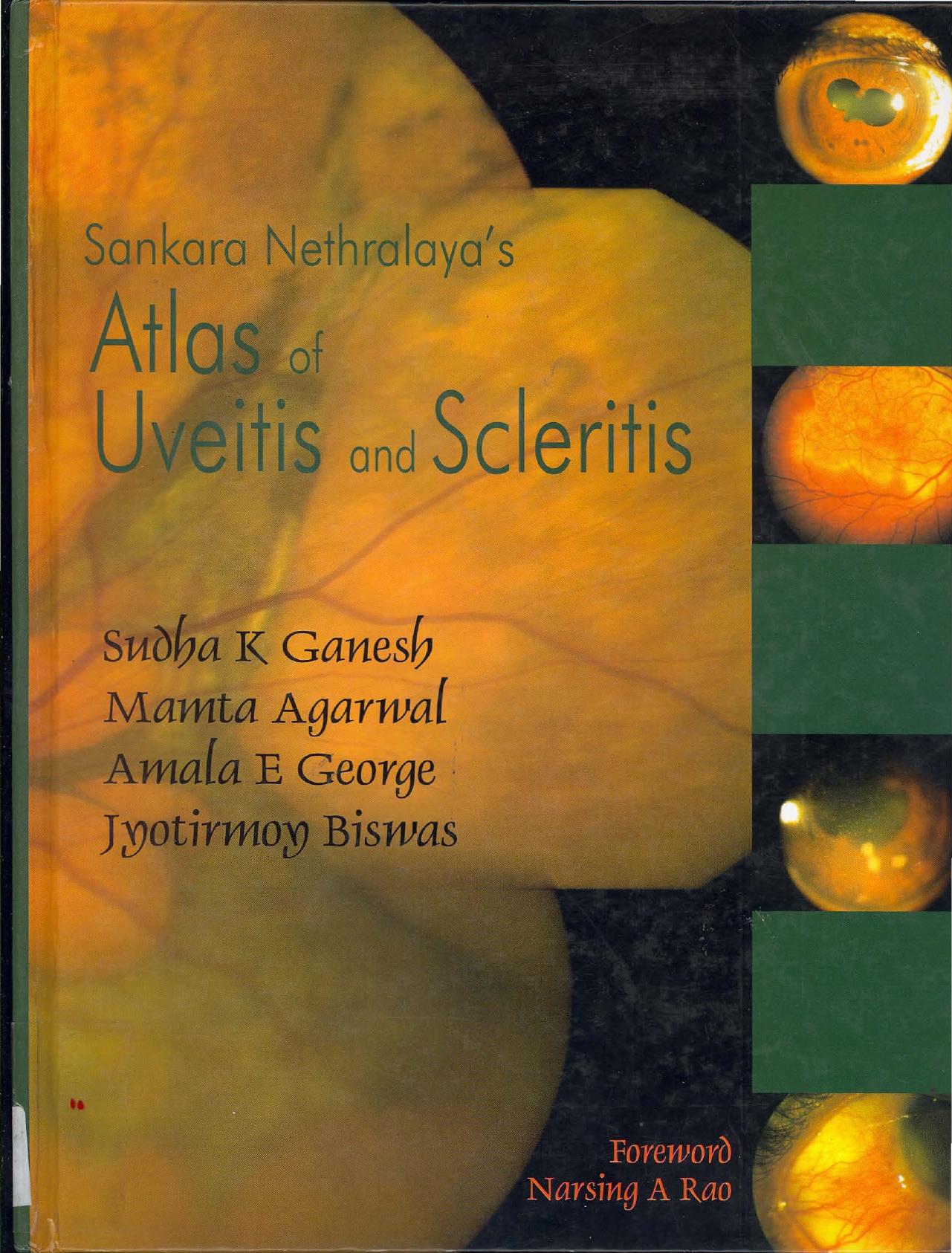 Atlas of Uvetis and Scleritis by Unknow