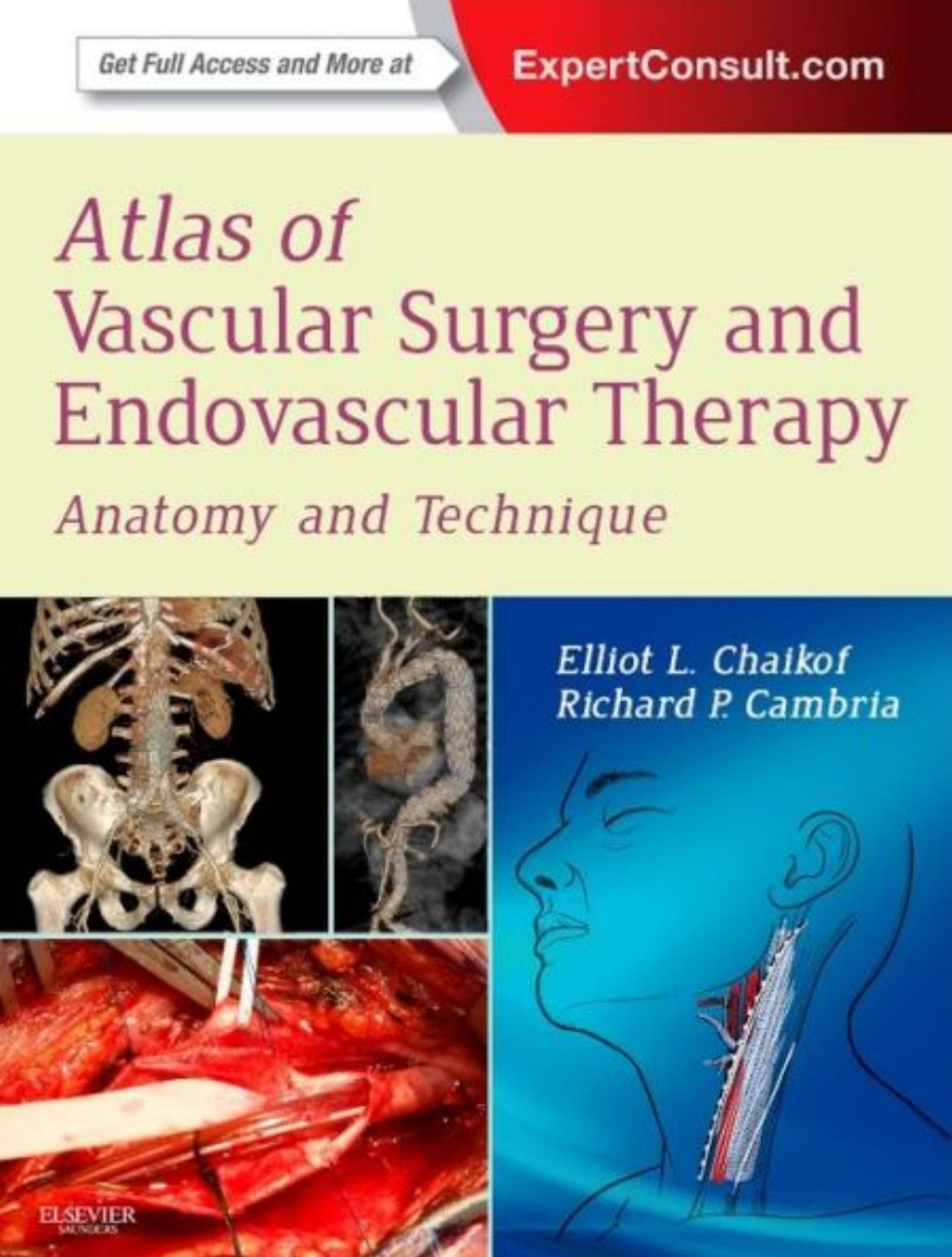 Atlas of Vascular Surgery and Endovascular Therapy: Anatomy and Technique by Elliot L. Chaikof