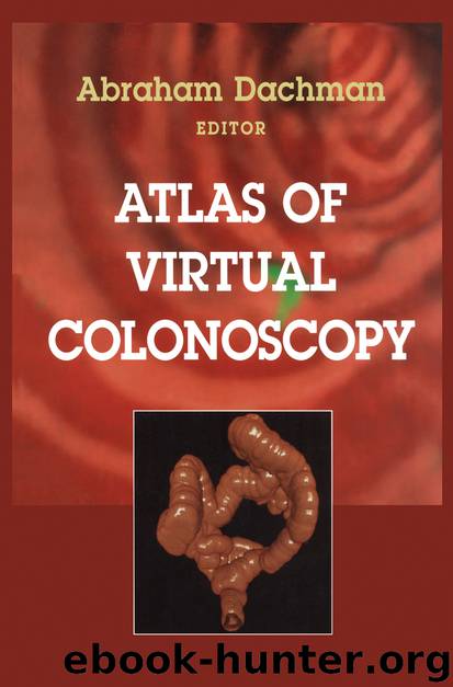Atlas of Virtual Colonoscopy by Abraham H.Dachman