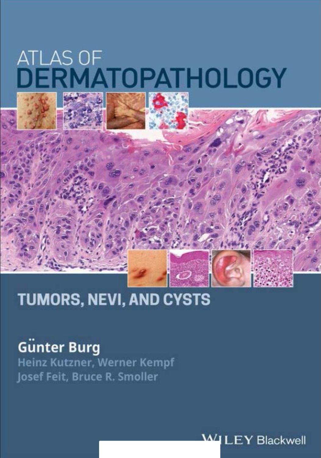 Atlas of dermatopathology : tumors, nevi, and cysts by Burg Günter; Feit Josef; Kempf Werner; Kutzner Heinz; Smoller Bruce R
