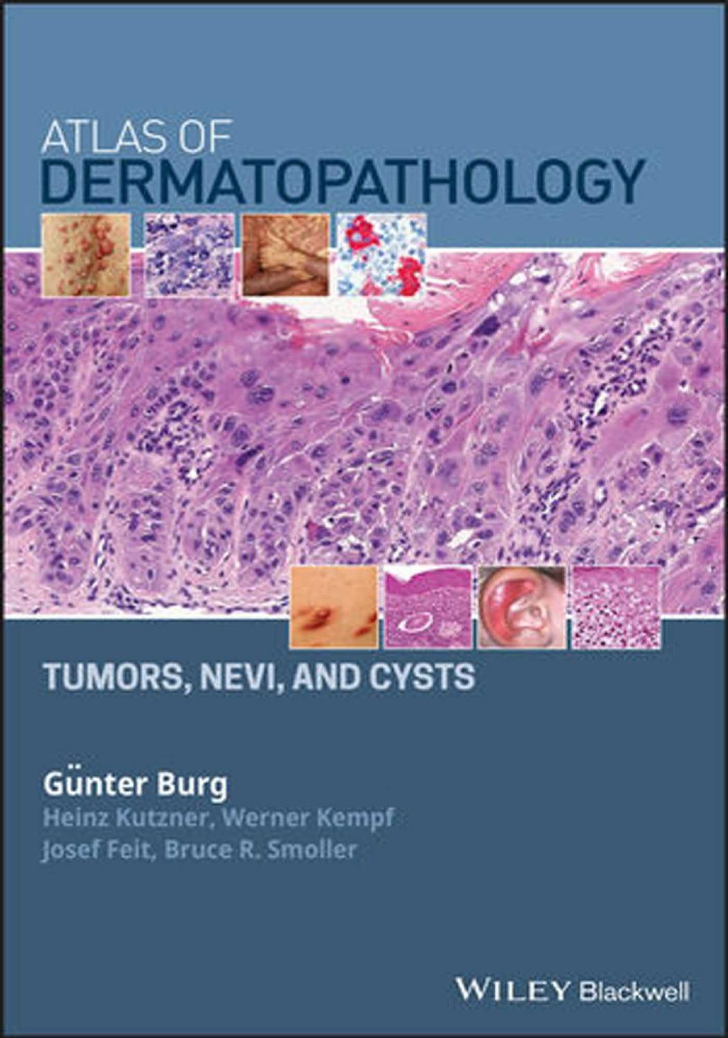 Atlas of dermatopathology tumors, nevi, and cysts by Burg Günter; Feit Josef; Kempf Werner; Kutzner Heinz; Smoller Bruce R