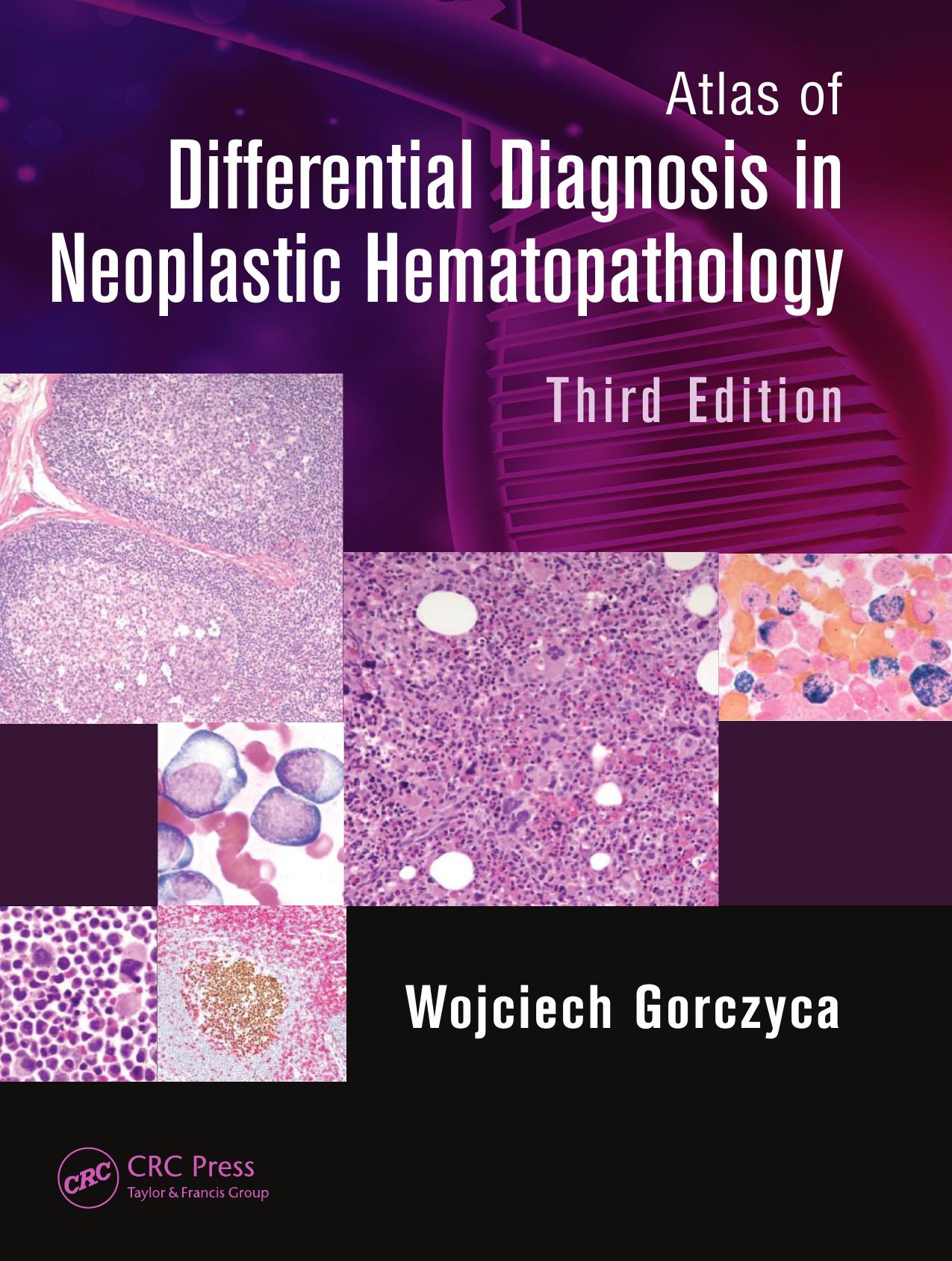 Atlas of differential diagnosis in neoplastic hematopathology by Gorczyca Wojciech