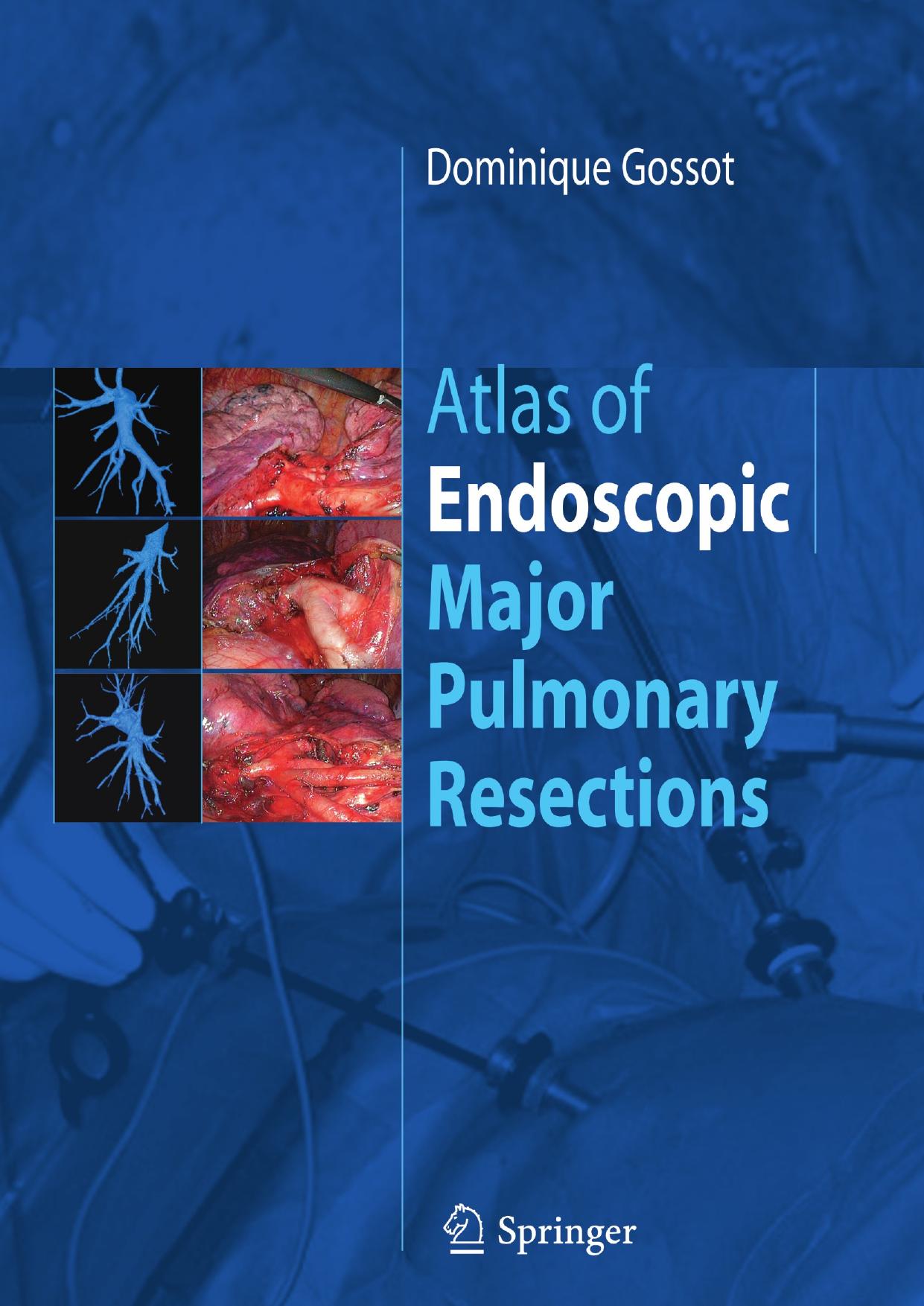 Atlas of endoscopic major pulmonary resections by Unknow