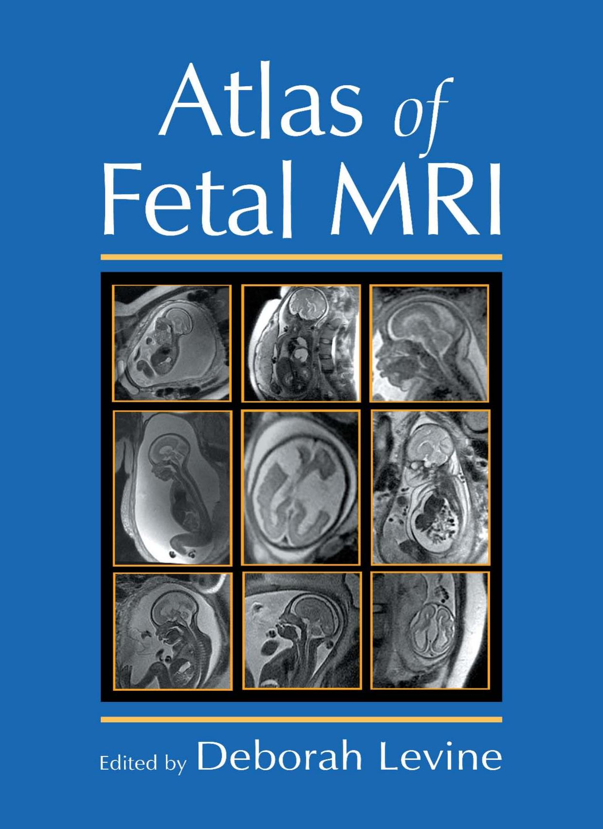 Atlas of fetal MRI by Deborah Levine