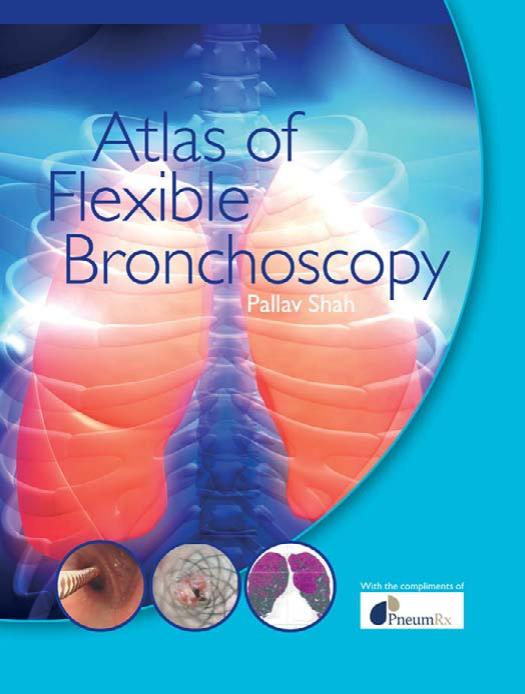 Atlas of flexible bronchoscopy by Pallav Shah