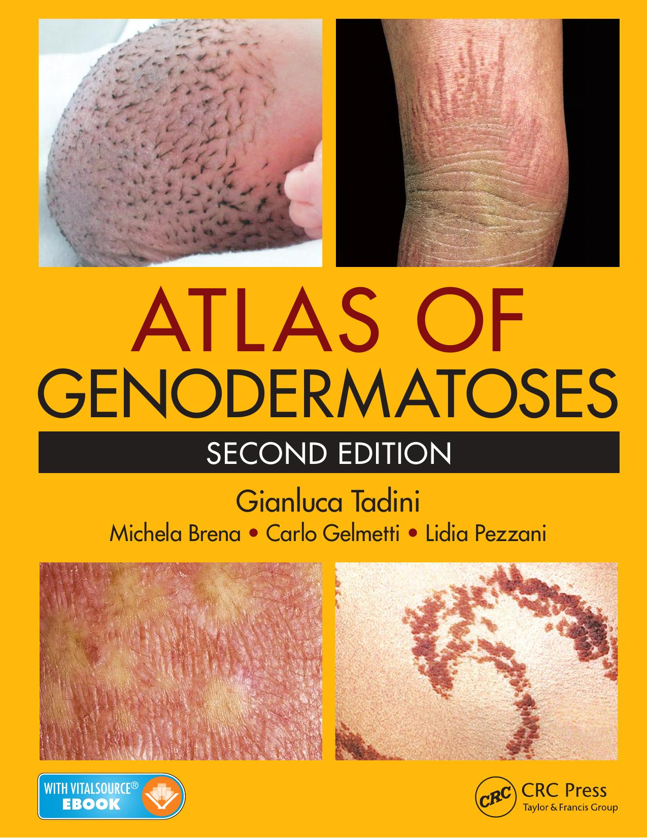 Atlas of genodermatoses by Tadini Gianluca
