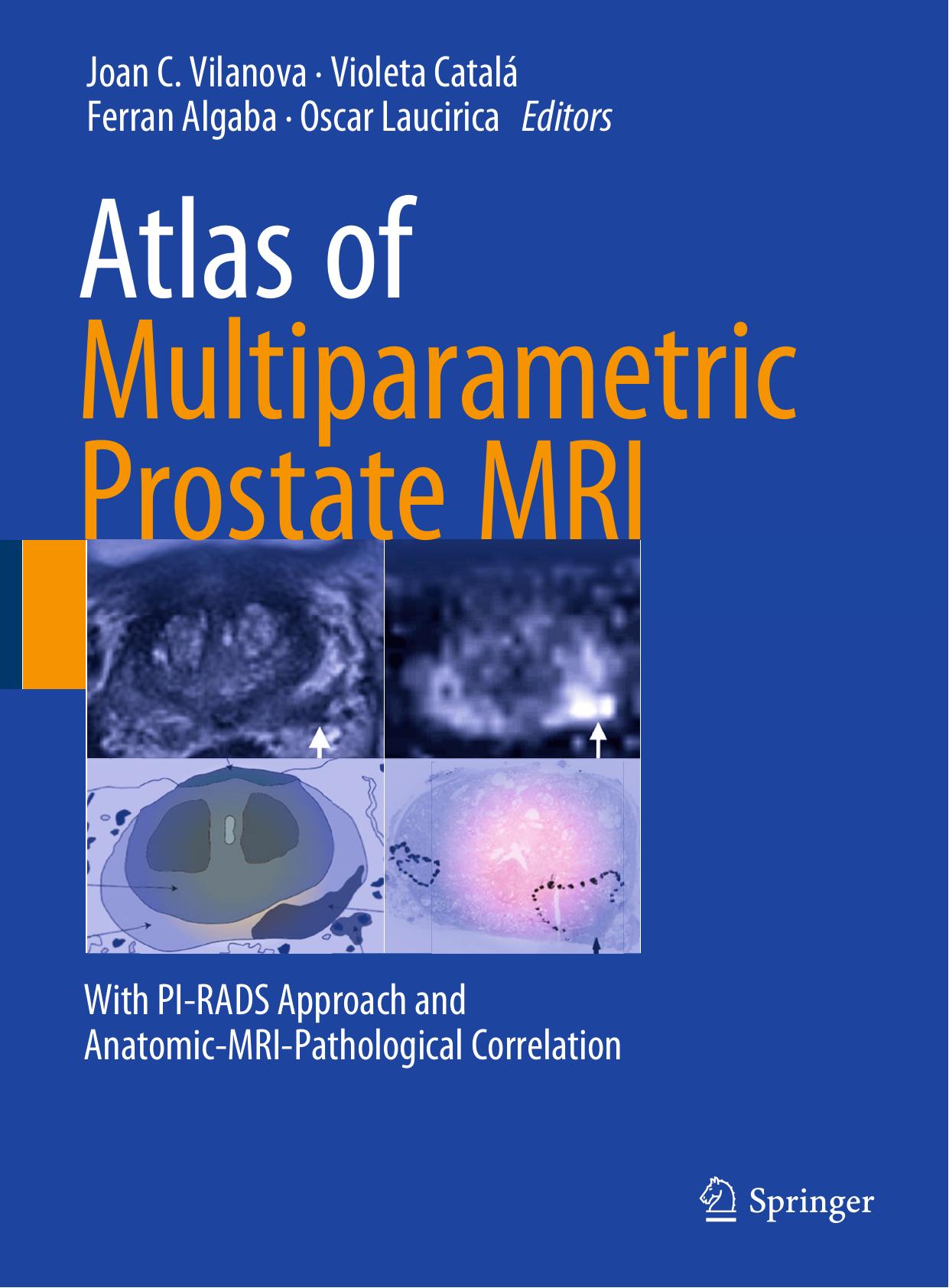 Atlas of multiparametric prostate MRI : with PI-RADS approach and anatomic-MRI-pathological correlation by Algaba