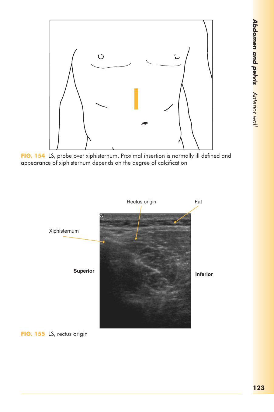 Atlas of musculoskeletal ultrasound anatomy by Dr Mike Bradley and Dr Paul O’Donnell