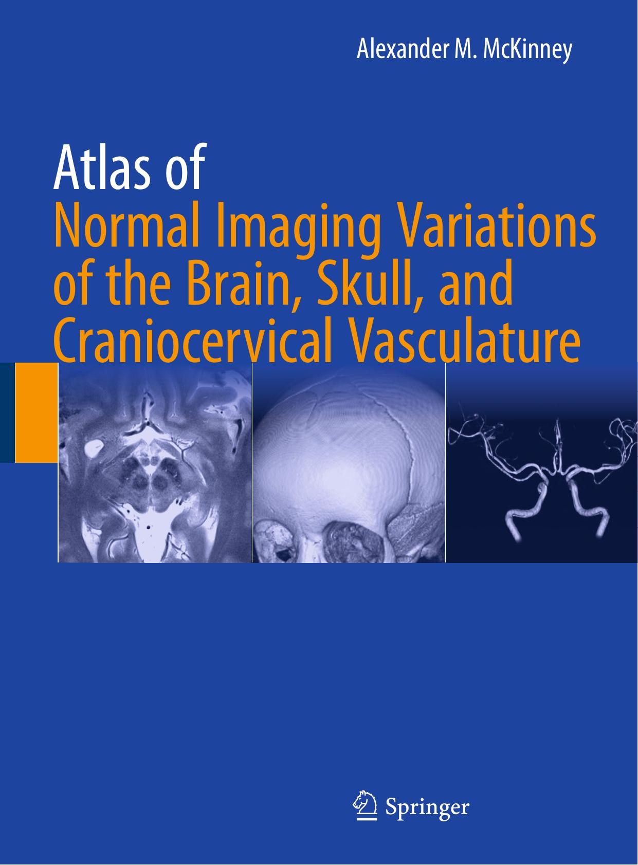 Atlas of normal imaging variations of the brain, skull, and craniocervical vasculature by McKinney Alexander M