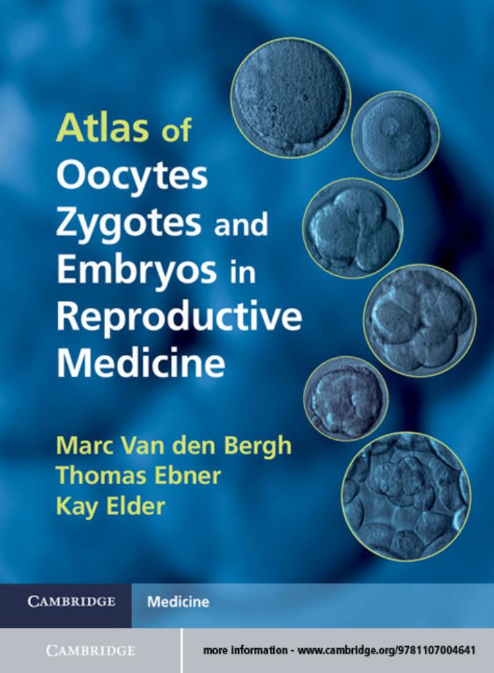 Atlas of oocytes, zygotes and embryos in reproductive medicine by Marc Van den Bergh; Thomas Ebner; Kay Elder