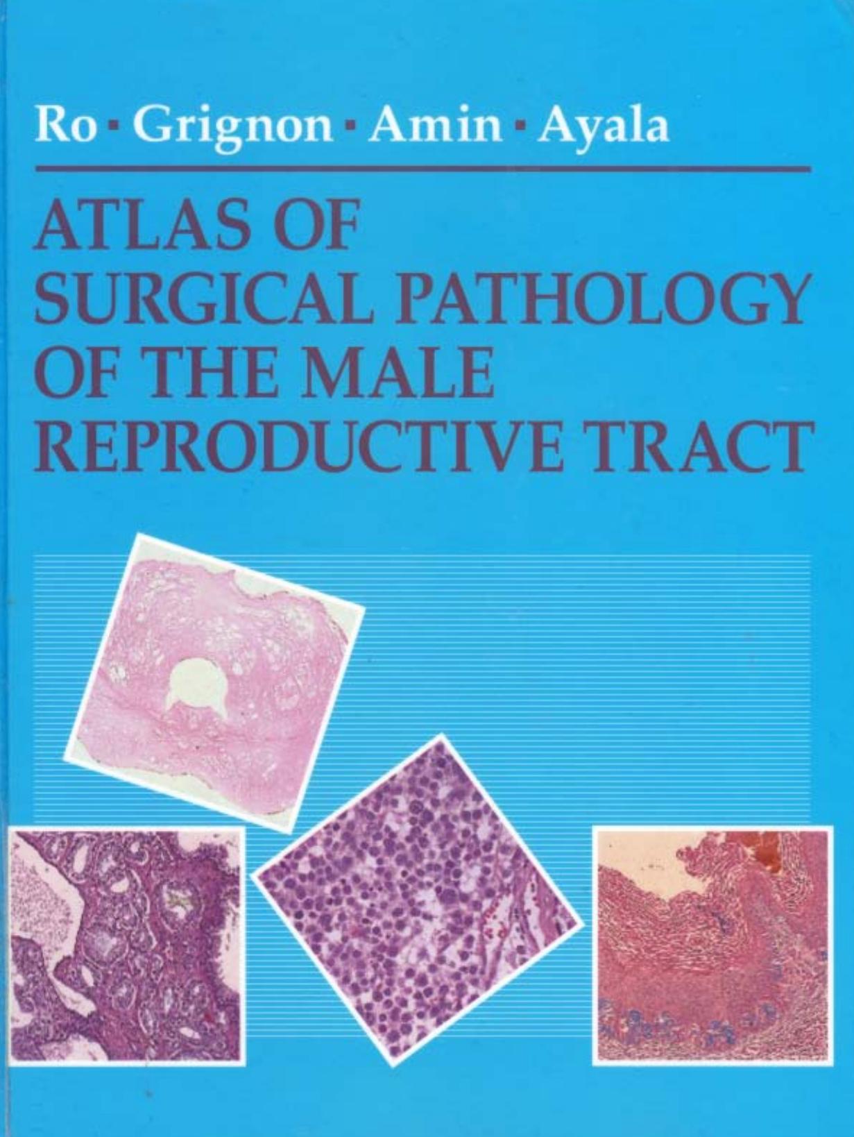 Atlas of surgical pathology of the male reproductive tract by Jae Y. Ro