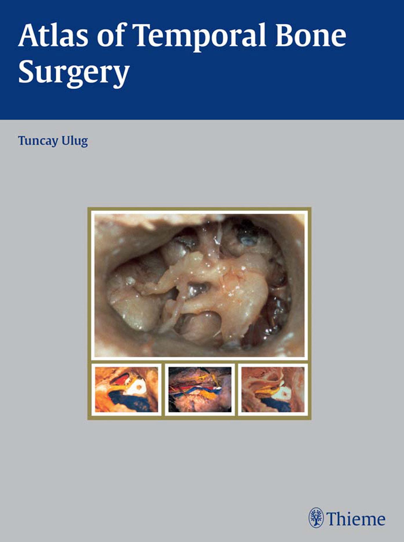 Atlas of temporal bone surgery by Ulug Tuncay