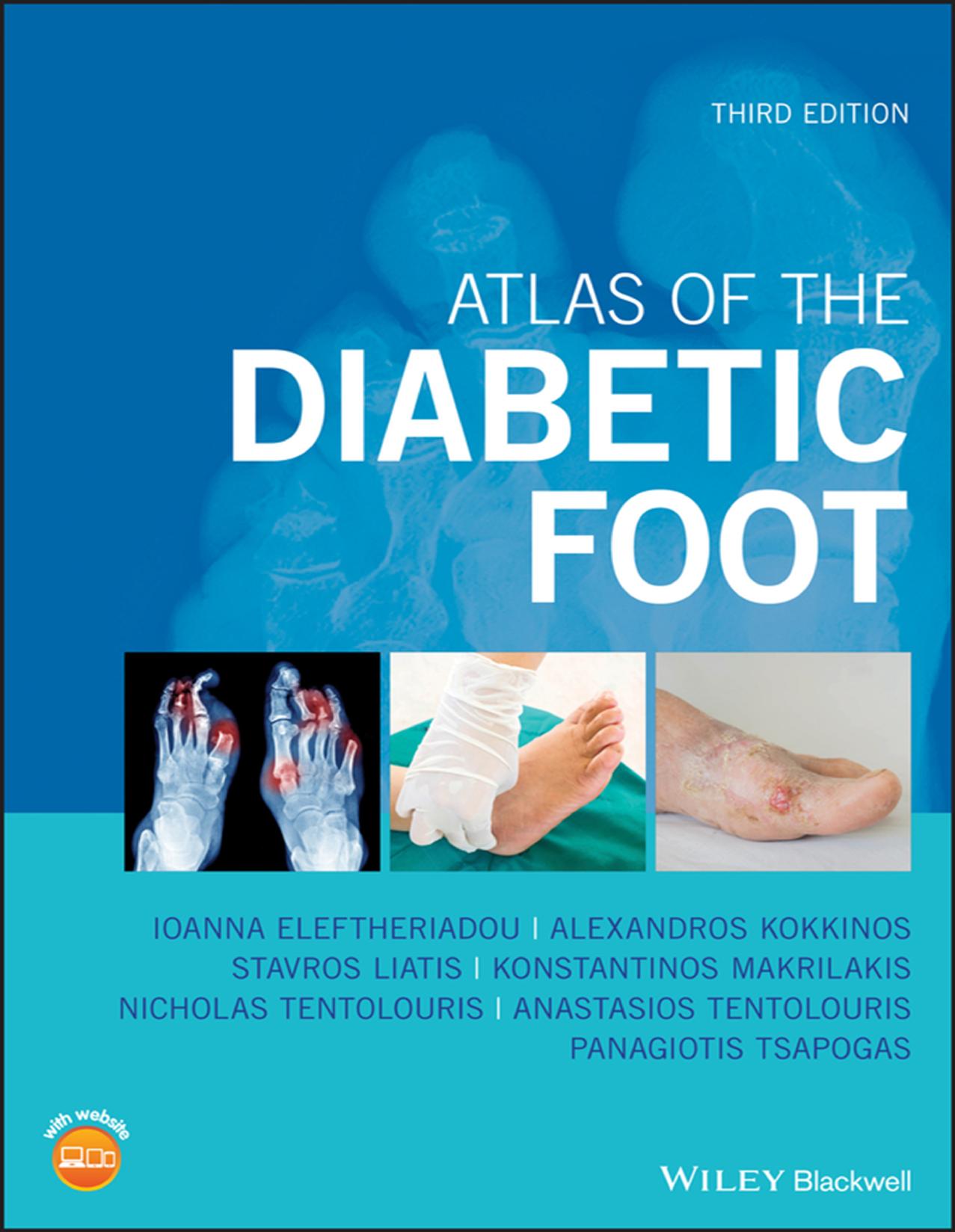 Atlas of the diabetic foot by Eleftheriadou Ioanna; Kokkinos Alexandros