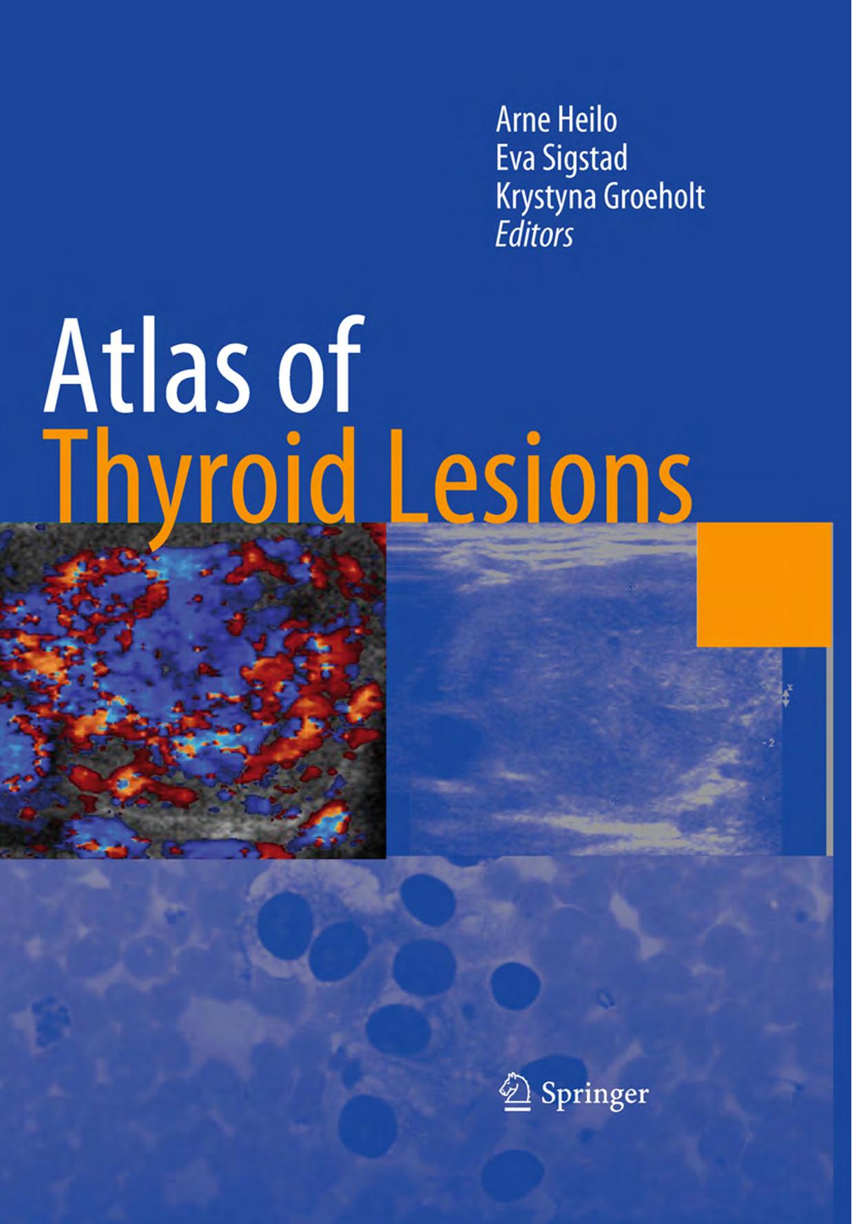 Atlas of thyroid lesions by Grøholt Krystyna; Heilo Arne; Sigstad Eva (eds.)