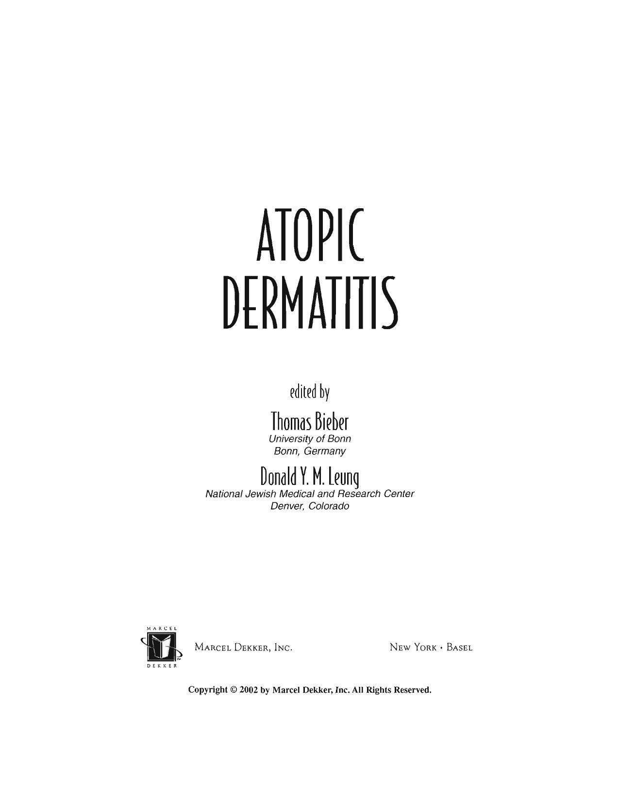 Atopic Dermatitis by Thomas Bieber Donald Leung