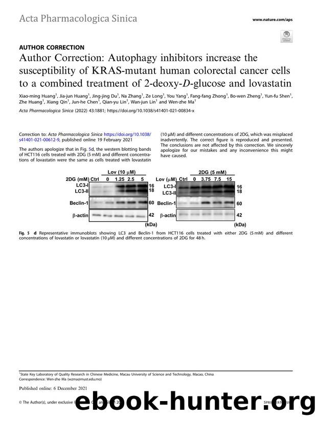 Author Correction: Autophagy inhibitors increase the susceptibility of KRAS-mutant human colorectal cancer cells to a combined treatment of 2-deoxy-D-glucose and lovastatin by unknow