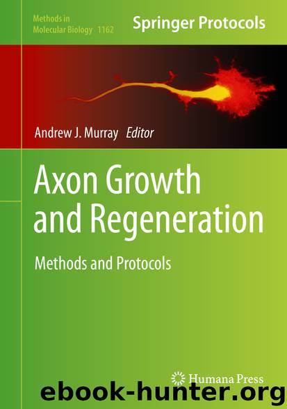 Axon Growth and Regeneration by Andrew J. Murray