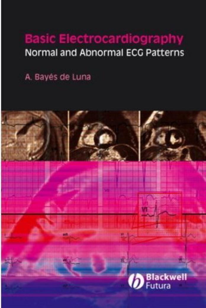 Basic Electrocardiography Normal and Abnormal ECG Patterns deLuna by Antoni Bayés de Luna