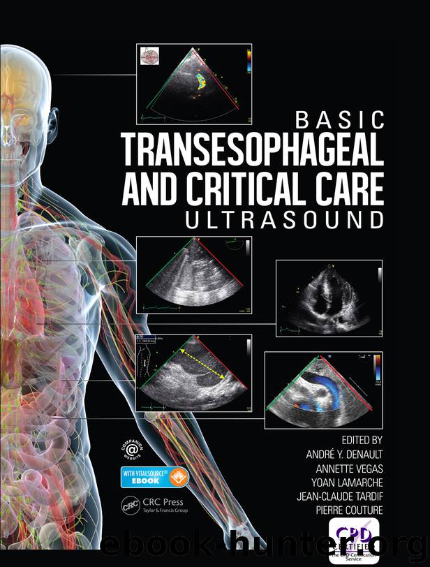 Basic Transesophageal and Critical Care Ultrasound by André Denault