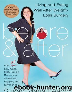 Before & After, Revised Edition by Susan Maria Leach