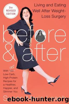 Before & After, Second: Living and Eating Well After Weight-Loss Surgery by Susan Maria Leach