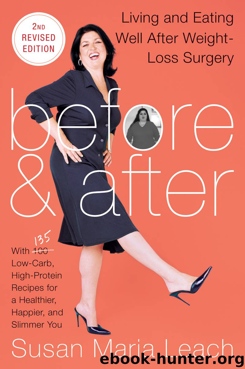 Before After, Second Revised Edition by Susan Maria Leach