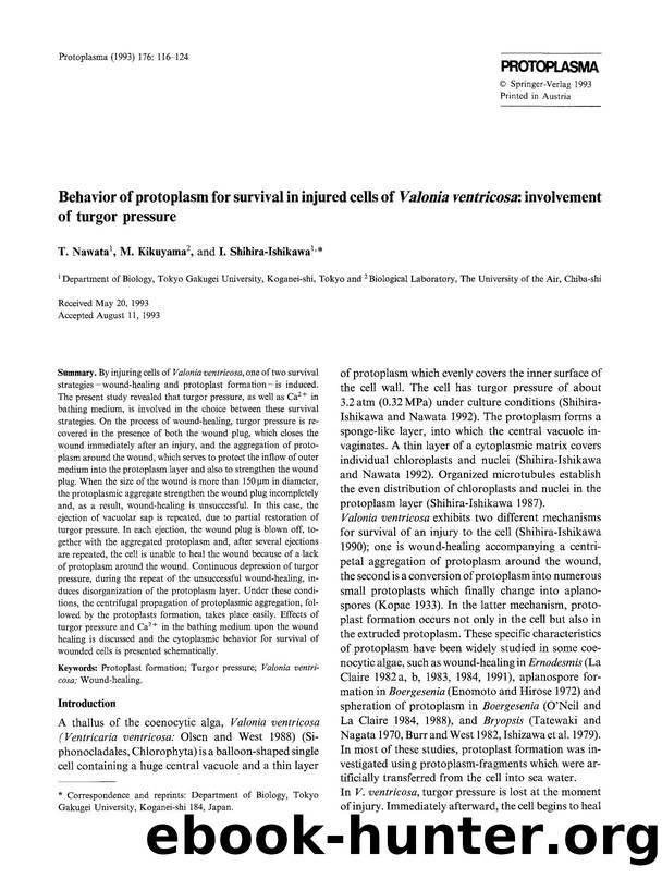 Behavior of protoplasm for survival in injured cells of <Emphasis Type="Italic">Valonia ventricosa <Emphasis>: involvement of turgor pressure by Unknown